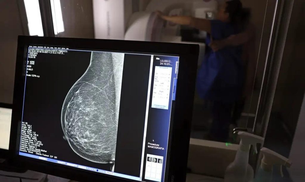 Reino Unido aprova medicamento que impede a propagação de um tipo de câncer de mama