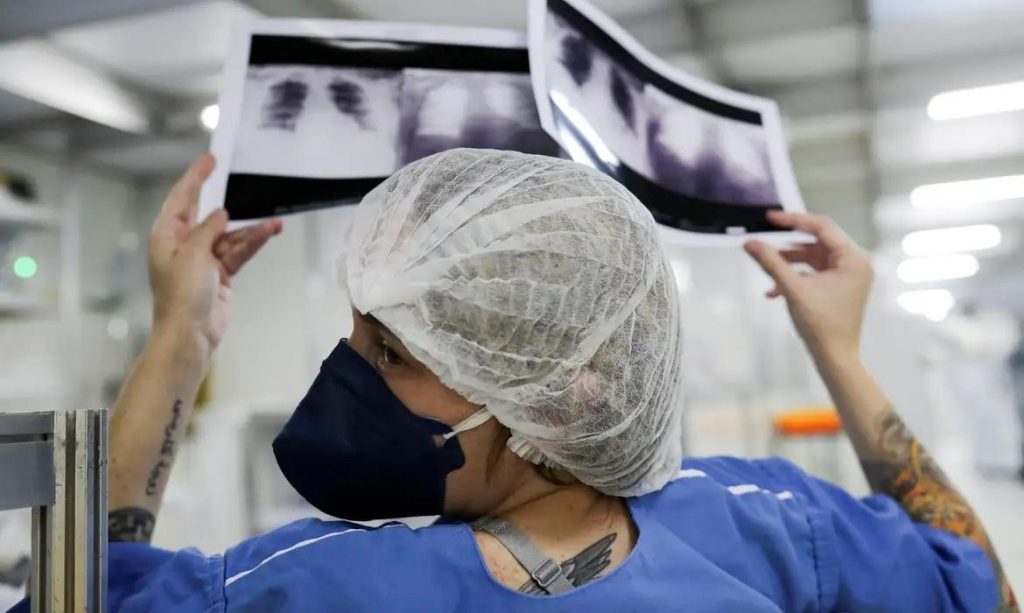 Tuberculose ainda é um grande desafio