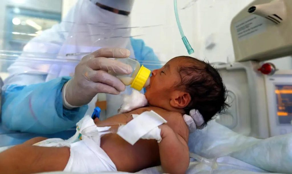 Unicef apela pela vida das crianças com desnutrição grave
