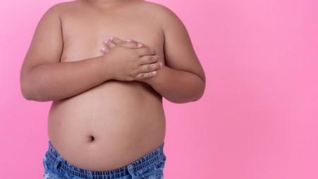 Obesidade infantil causa danos vasculares precoces, indica estudo