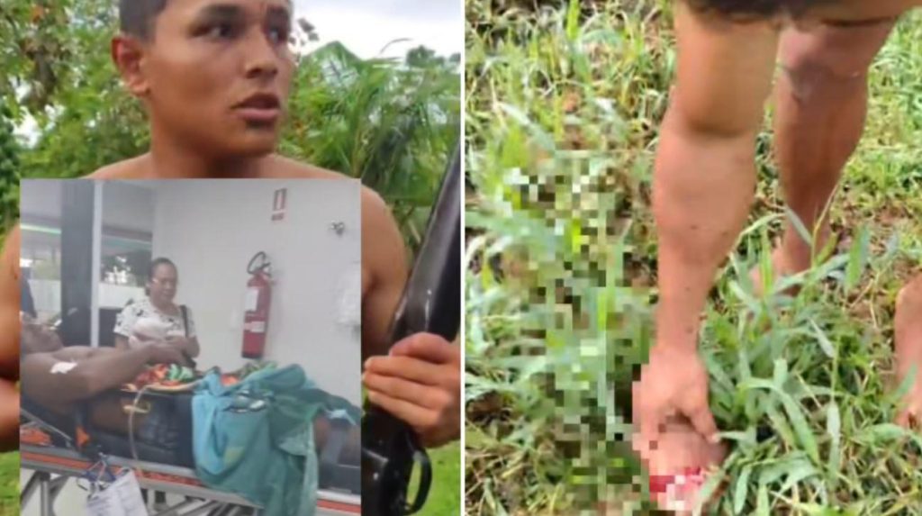 Briga em Manacapuru termina com mão decepada e disparo de arma de fogo