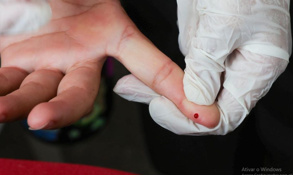 Brasil atinge meta de redução da transmissão vertical de hepatite B